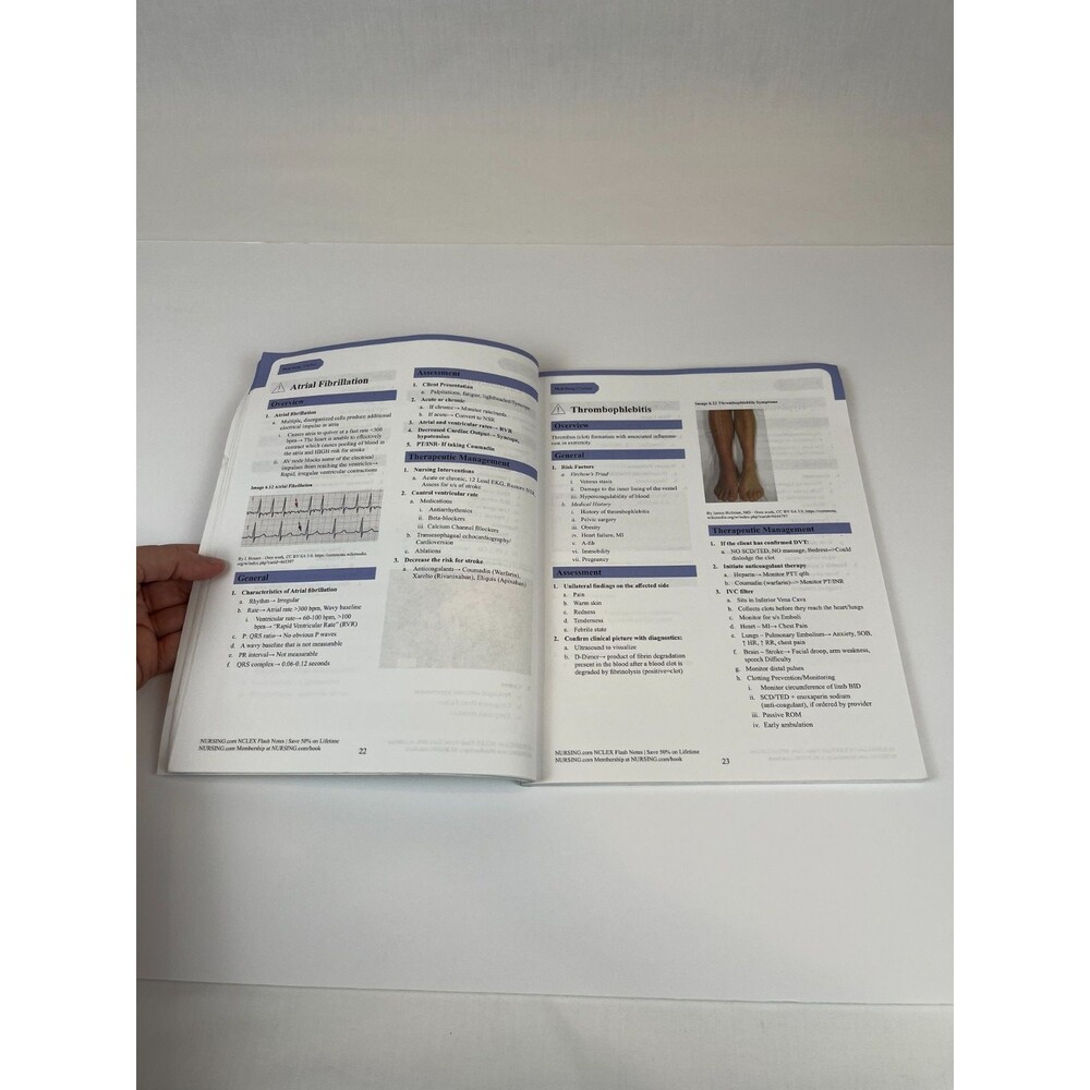 NCLEX Flash Notes: 77 Essential Nursing Topics for NCLEX Success Study Guide - Picture 13 of 16